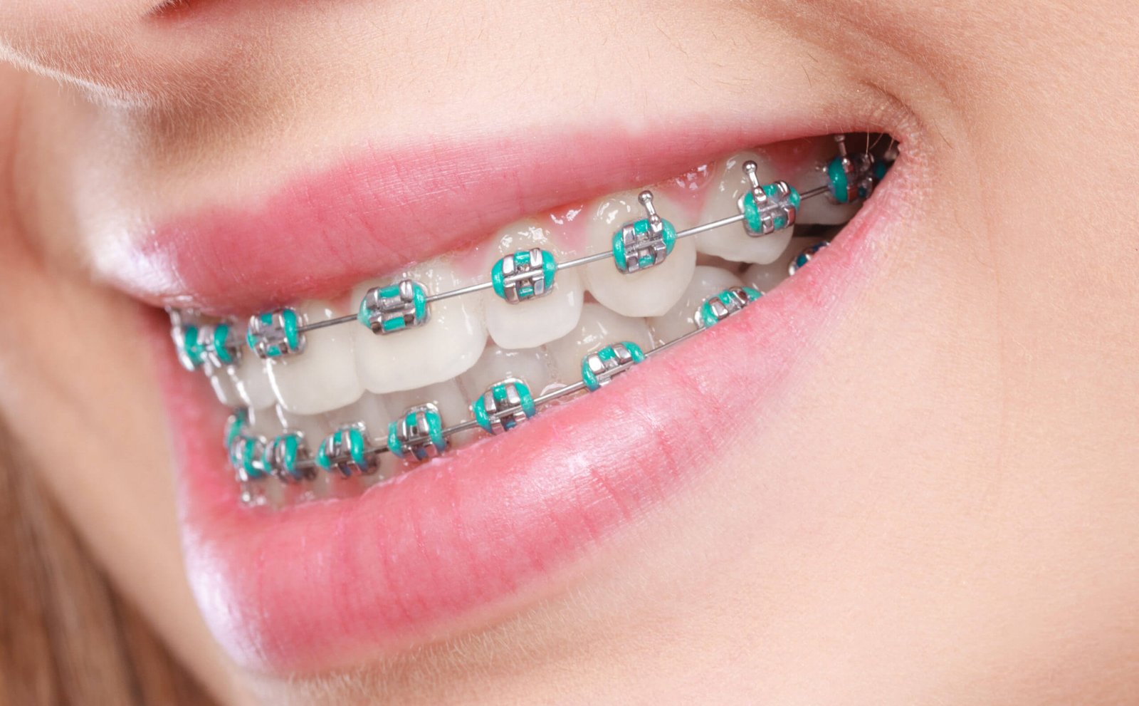 Dental Clinic Near me So smile dental clinic best dentist in Lahore female dentist near me